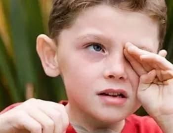 3岁男孩误将502当眼药水，宝妈的做法堪称教科书，保住了儿子的眼