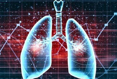 肺动脉高压可以控制吗,需要注意什么事项图4